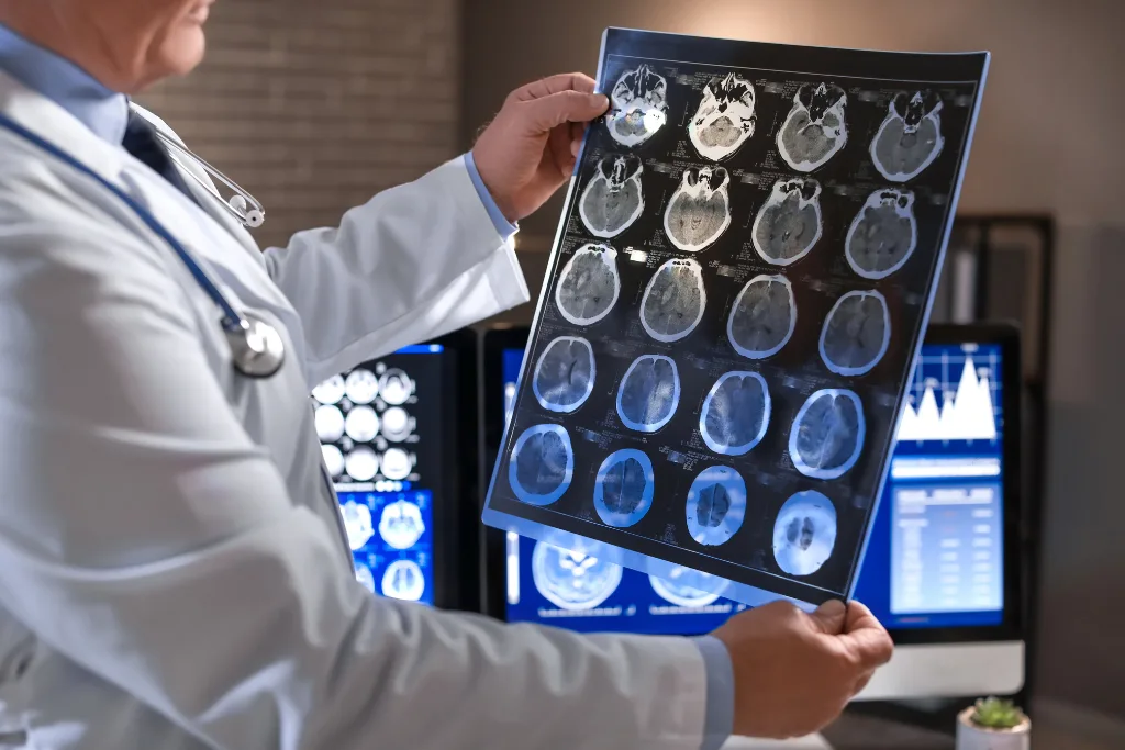 Online Neurologists Provide Legal Reports